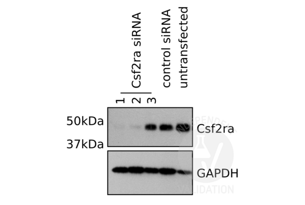 CSF2RA 抗体  (Center)