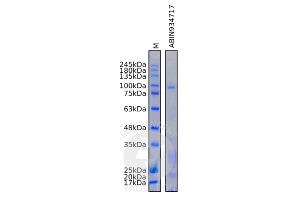 Thyroperoxidase 蛋白