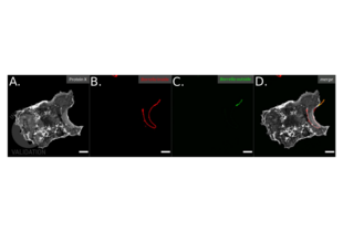 Immunofluorescence validation image for anti-Borrelia Burgdorferi antibody (ABIN236885) (Borrelia Burgdorferi 抗体)