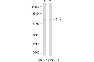 Image no. 2 for anti-Checkpoint Kinase 1 (CHEK1) (Ser317) antibody (ABIN197292) (CHEK1 抗体  (Ser317))