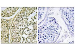 Immunohistochemistry (IHC) image for anti-Casein Kinase 1, alpha 1-Like (CSNK1A1L) (Internal Region) antibody (ABIN1849778) (CSNK1A1L 抗体  (Internal Region))