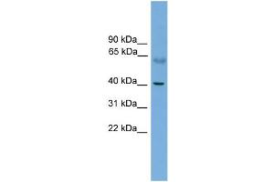 WB Suggested Anti-PRKACA Antibody Titration: 0. (PRKACA 抗体  (N-Term))