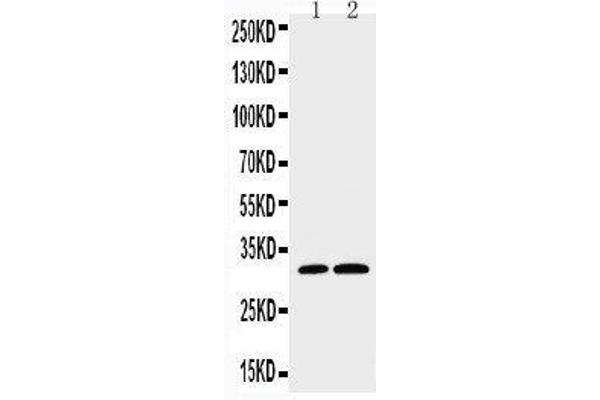 Caspase 3 抗体  (C-Term)