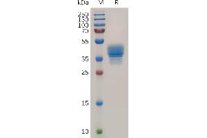 CCR3 Protein (AA 1-34) (Fc Tag)