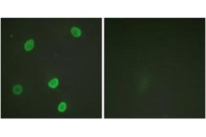 Immunofluorescence analysis of HeLa cells, using Histone H4 (Acetyl-Lys8) Antibody. (Histone H4 抗体  (acLys8))