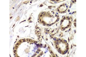 Immunohistochemistry of paraffin-embedded Human breast using HDAC4 Polyclonal Antibody at dilution of 1:100 (40x lens). (HDAC4 抗体)