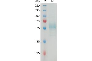 Mouse T Protein, hFc Tag on SDS-PAGE under reducing condition. (TREM2 Protein (AA 19-171) (Fc Tag))