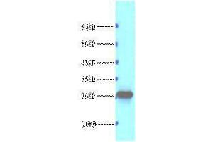 Western Blotting (WB) image for anti-B-Cell CLL/lymphoma 2 (BCL2) antibody (ABIN3178594) (Bcl-2 抗体)