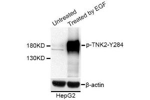 Western blot analysis of extracts of HepG2 cells, using Phospho-TNK2-Y284 antibody (ABIN5995622) at 1/1000 dilution. (TNK2 抗体  (pTyr284))