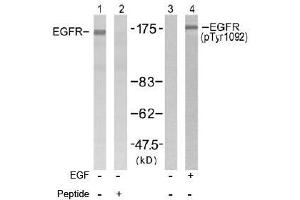Image no. 2 for anti-Epidermal Growth Factor Receptor (EGFR) (Tyr1092) antibody (ABIN197231) (EGFR 抗体  (Tyr1092))