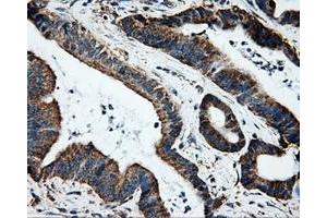 Immunohistochemical staining of paraffin-embedded Kidney tissue using anti-HSD17B10mouse monoclonal antibody. (HSD17B10 抗体)