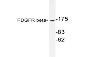Western blot (WB)analyzes of PDGFR beta antibody in extracts from NIH/3T3 cells. (PDGFRB 抗体)