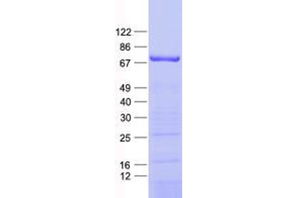 ZNF549 Protein (His tag)