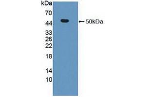 Western blot analysis of recombinant Human MMP19. (MMP19 抗体  (AA 98-508))