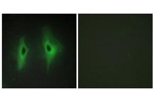 Immunofluorescence analysis of HeLa cells, using DGKH antibody. (DGKH 抗体  (Internal Region))