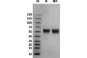 Human Fc gamma RIIIa / CD16a (176V) protein on Coomassie Blue stained SDS-PAGE under non-reducing (NR) and reducing (R) conditions. (FCGR3A Protein (AA 17-208) (His-Avi Tag))
