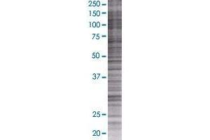 DGCR6 transfected lysate. (DGCR6 293T Cell Transient Overexpression Lysate(Denatured))