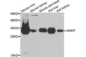 Western blot analysis of extracts of various cell lines, using GNMT antibody. (GNMT 抗体)