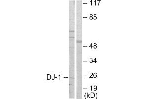 Western blot analysis of extracts from HuvEc cells, using DJ-1 antibody (#C0172). (PARK7/DJ1 抗体)