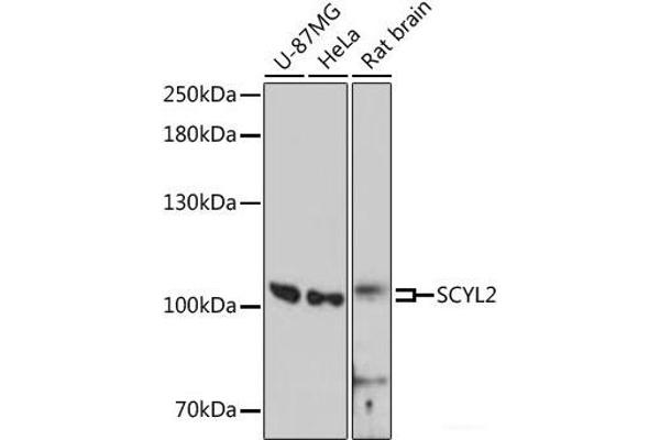 SCYL2 抗体