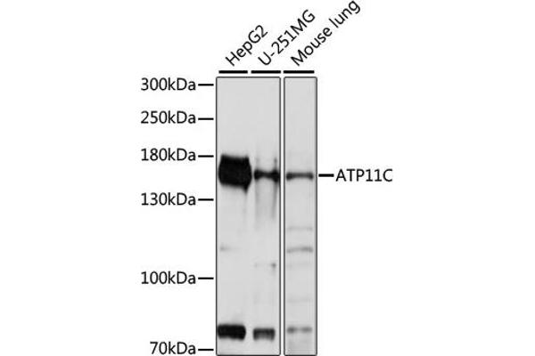 ATP11C 抗体  (AA 430-650)