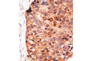 Image no. 2 for anti-Apolipoprotein B mRNA Editing Enzyme, Catalytic Polypeptide-Like 3G (APOBEC3G) (C-Term) antibody (ABIN356860) (APOBEC3G 抗体  (C-Term))