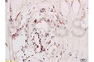 Immunohistochemistry (IHC) image for anti-Chemokine (C-X-C Motif) Receptor 4 (CXCR4) (AA 201-294) antibody (ABIN730888)