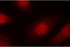 Immunofluorescence (IF) image for anti-Retinoblastoma 1 (RB1) (pSer780) antibody (ABIN1870571) (Retinoblastoma 1 抗体  (pSer780))