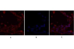 Immunofluorescence analysis of human lung tissue. (IRS1 抗体)