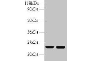 Western blot All lanes: RBP4 antibody at 2 μg/mL Lane 1: Human positive serum at 1: 10 Lane 2: Human positive serum at 1: 100 Secondary Goat polyclonal to rabbit IgG at 1/50000 dilution Predicted band size: 24 kDa Observed band size: 24 kDa (RBP4 抗体  (AA 19-201))