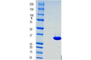 Pyrophosphatase (Inorganic) 1 (PPA1) protein (His tag)