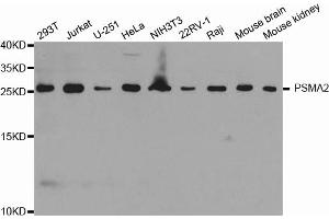 Western blot analysis of extracts of various cell lines, using PSMA2 antibody. (PSMA2 抗体)