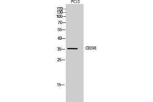 Western Blotting (WB) image for anti-ATPase, Na+/K+ Transporting, beta 3 Polypeptide (ATP1B3) (Internal Region) antibody (ABIN3181462) (ATP1B3 抗体  (Internal Region))