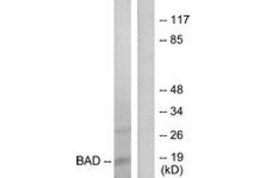 Western blot analysis of extracts from 293 cells, treated with Forskolin, using BAD (Ab-136) Antibody. (BAD 抗体  (AA 102-151))