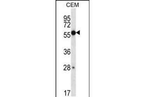 Western blot analysis in CEM cell line lysates (35ug/lane). (ZNF764 抗体  (AA 84-113))