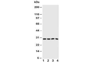 Western blot testing of Carbonic Anhydrase III antibody and Lane 1:  SMMC-7721 (CA3 抗体  (N-Term))