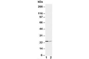 Western blot testing of SOCS1 antibody and Lane 1:  HT1080;  2: COLO320 cell lysate. (SOCS1 抗体  (C-Term))