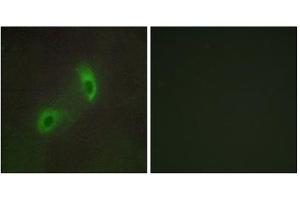Immunofluorescence analysis of HUVEC cells, using HGS antibody. (HGS 抗体  (Internal Region))
