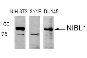 Western blot analysis of extract from NIH3T3 (Mouse), 3Y1E (Rat), DU145 (Human) cells using Niban like protein 1(Ab-712) antibody (E021332). (MEG3 抗体)