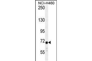 Western blot analysis in NCI-H460 cell line lysates (35ug/lane). (ATXN7L2 抗体  (C-Term))