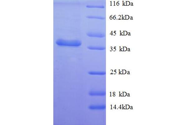 Nerve Growth Factor Receptor (TNFRSF16) Associated Protein 1 (NGFRAP1) (AA 1-111), (full length) protein (GST tag)