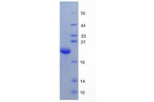 SDS-PAGE analysis of Human Hemojuvelin Protein. (HFE2 蛋白)