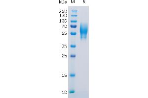 Human 5T4 Protein, His Tag on SDS-PAGE under reducing condition. (TPBG Protein (AA 32-355) (His tag))
