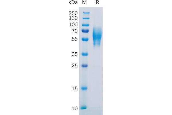 TPBG Protein (AA 32-355) (His tag)