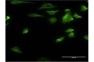 Immunofluorescence of monoclonal antibody to HDAC6 on HeLa cell. (HDAC6 抗体  (AA 1-1063))