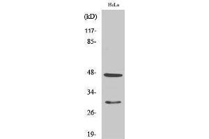Western Blotting (WB) image for anti-Cathepsin D (CTSD) (Internal Region) antibody (ABIN3174201) (Cathepsin D 抗体  (Internal Region))