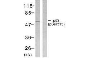 Western blot analysis of extracts from ovary cancer cells using p53 (phosphor-Ser315) antibody (E011100). (p53 抗体  (pSer315))