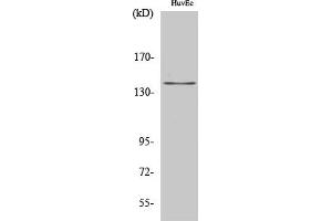 Western Blot analysis of HuvEc cells using Amyloid-β Polyclonal Antibody diluted at 1:2000. (beta Amyloid 抗体)