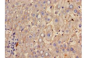 Immunohistochemistry of paraffin-embedded human liver tissue using ABIN7154060 at dilution of 1:100 (GGT1 抗体  (AA 13-225))