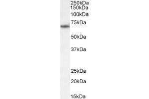 Western Blotting (WB) image for anti-phosphoenolpyruvate Carboxykinase 2 (Mitochondrial) (PEPCK) (Internal Region) antibody (ABIN185483)